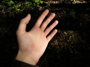 Numbness in the limbs